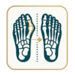 foot